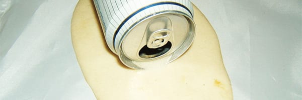 Cans on floors are a trip hazard - especially in A&E